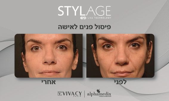 פיסול פנים סטילאז'